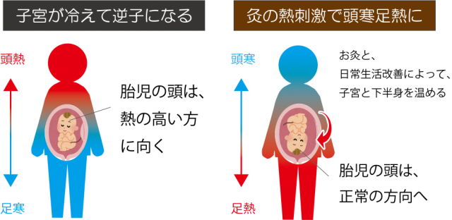 逆子のことならお任せください 渋谷区代々木 神子整体院 逆子のことならお任せください 渋谷区代々木 神子整体院